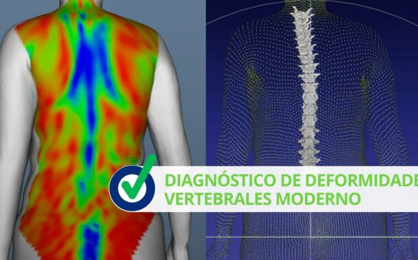 Diagnóstico de deformidades vertebrales moderno