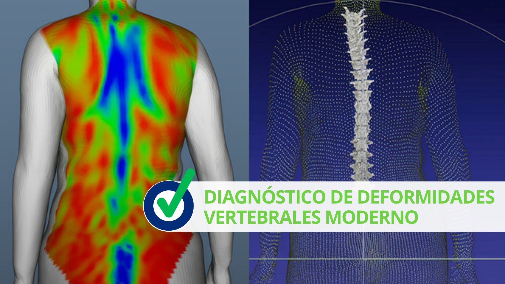 Diagnóstico de deformidades vertebrales moderno