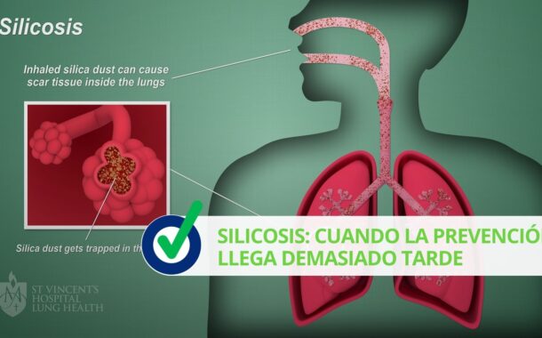 Silicosis: cuando la prevención llega demasiado tarde