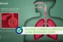 Silicosis: cuando la prevención llega demasiado tarde