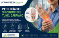 Patología del Síndrome del Túnel Carpiano